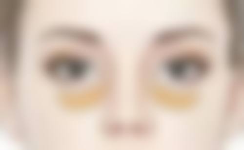 三、日常护理建议