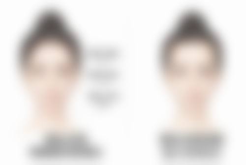 被虫子咬的疤痕慢慢变黑了怎么办？科学护理与医学手段助你有效淡化疤痕 