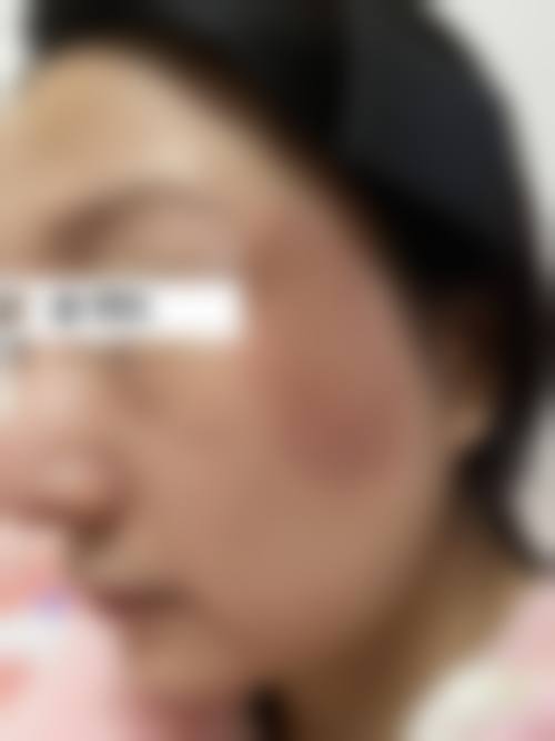 二、连云港亿大整形美容医院怎么样？