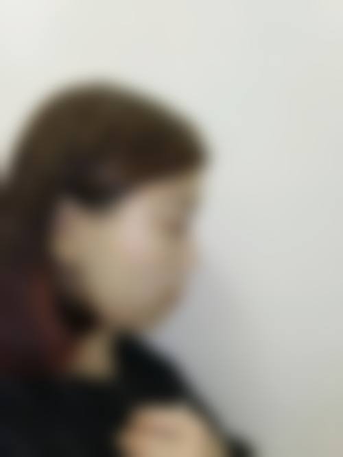 四、杭州艾博美瑞医疗门诊部特色项目