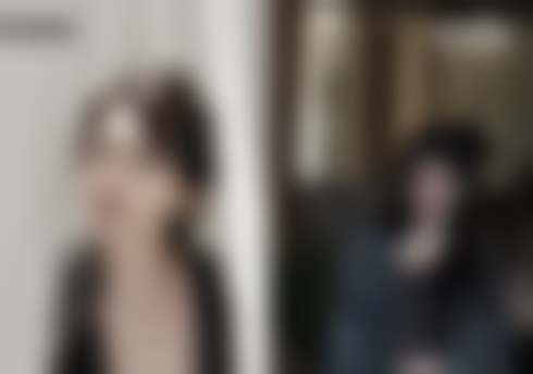 一、面部抽脂可以做吗？先看看适用情况