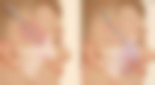 八、河南新乡弈诺美医疗美容诊所真实的患者评价