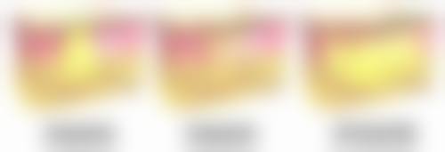 二、双眼皮第六天能拆线吗？看看拆线前后的注意事项