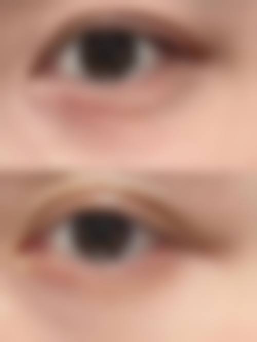 八、长沙凯思丽医疗美容门诊部真实的患者评价