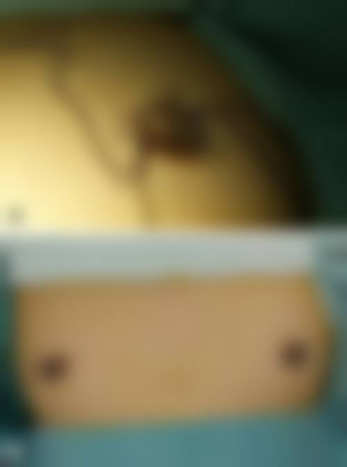 六、庆阳市人民医院医疗美容科地址及交通