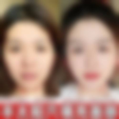 八、泰国艺术整形外科中 心真实的患者评价