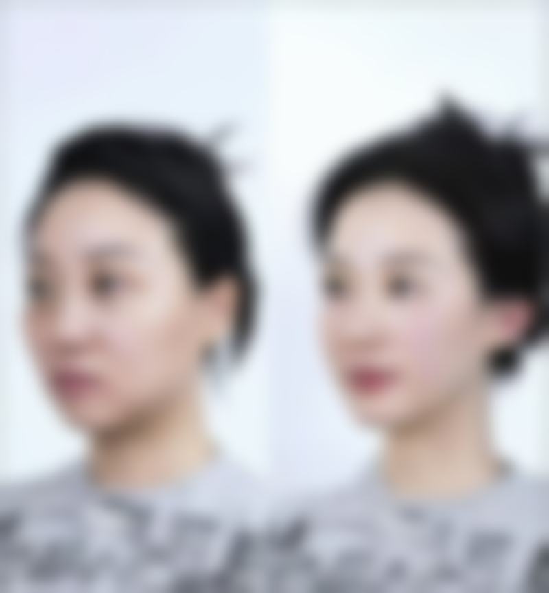 九、昆明维多利亚医疗美容医院真实的患者评价