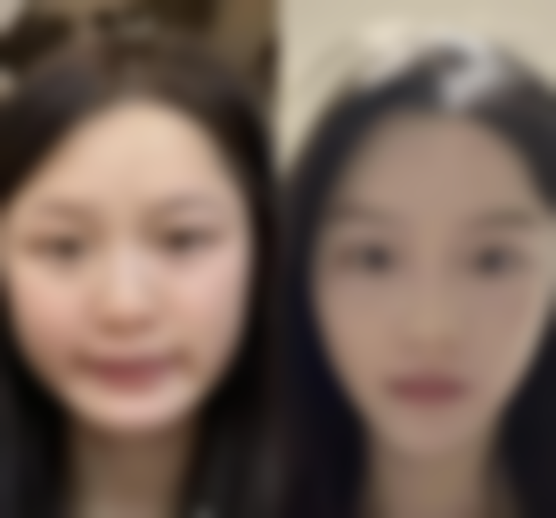 二、疤痕增生的基本情况