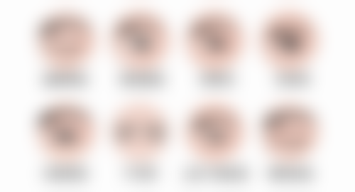 四、割双眼皮疤痕增生怎么办