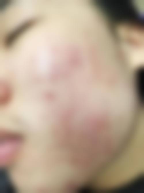 八、河南南阳惠康皮肤医院预约方式