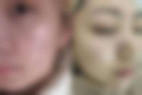 八、光皮肤科医院清潭真实的患者评价