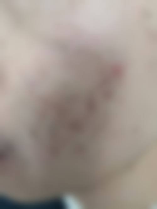 四、河南南阳惠康皮肤医院特色项目