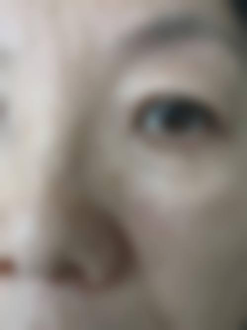 二、河南南阳惠康皮肤医院怎么样？