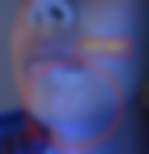 六、河南南阳惠康皮肤医院价格表