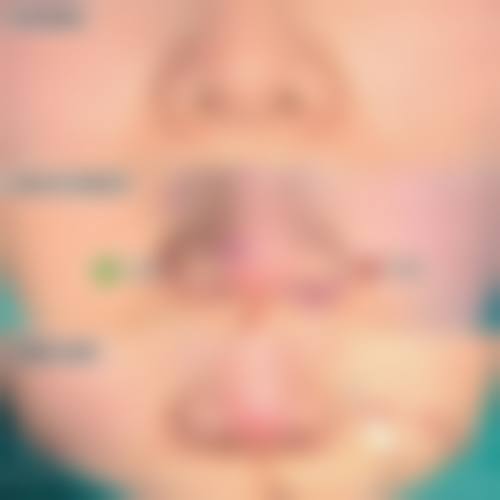 四、松本Skin Clinic特色项目