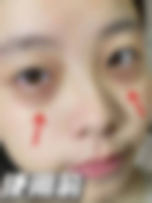 五、松本Skin Clinic价格表