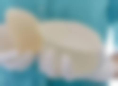 一、物理治疗消除眼袋