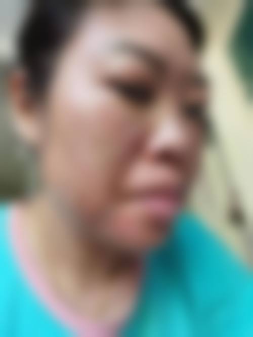 三、韩国Dal:B整形外科诊疗项目有哪些？