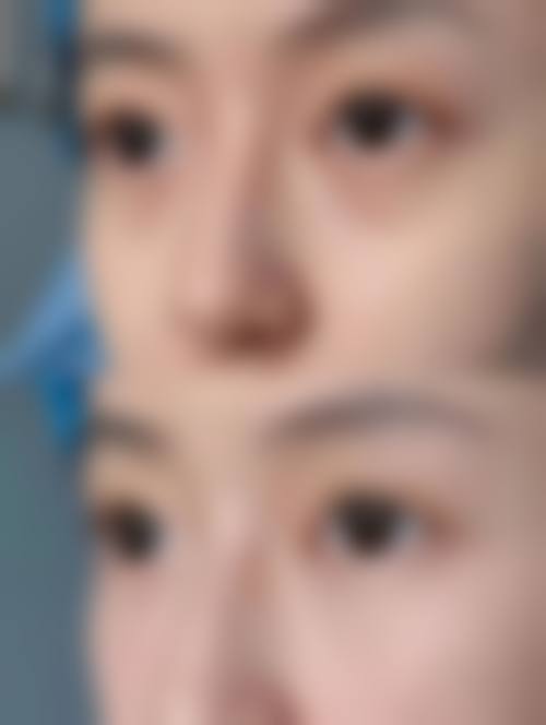 八、南京颜如玉整形医院预约方式