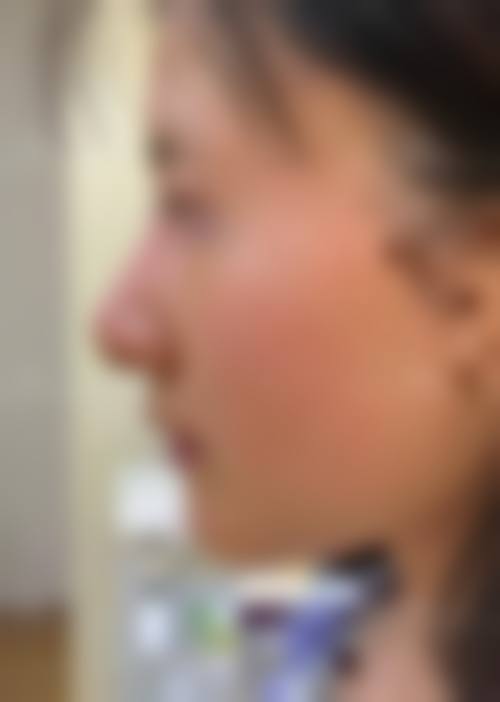 四、韩国Dal:B整形外科特色项目