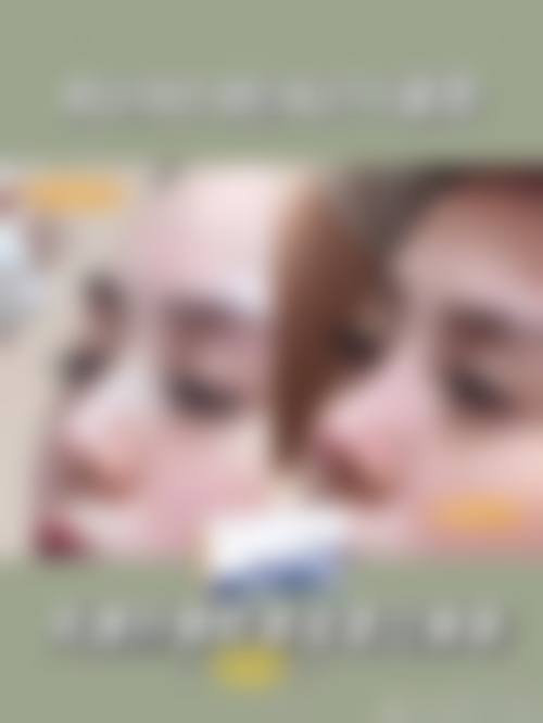 八、韩国Dal:B整形外科真实的患者评价