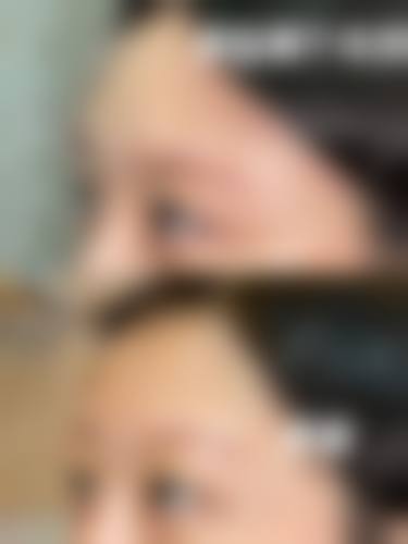 八、安阳仁济医院医疗美容科真实的患者评价