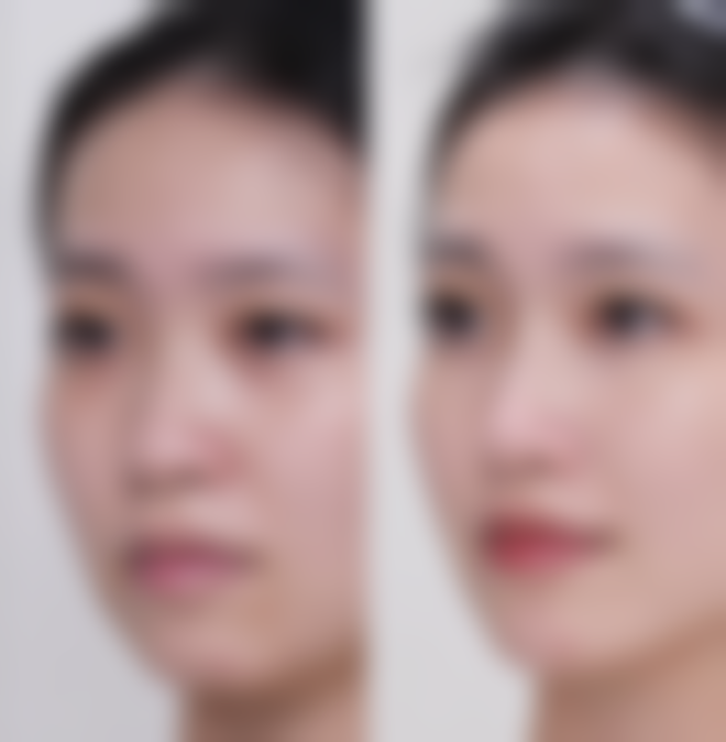 五、大蒜汁能去眼袋吗？科学总结