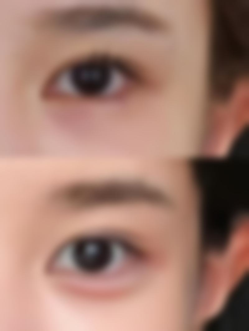 三、日常护理消除眼袋