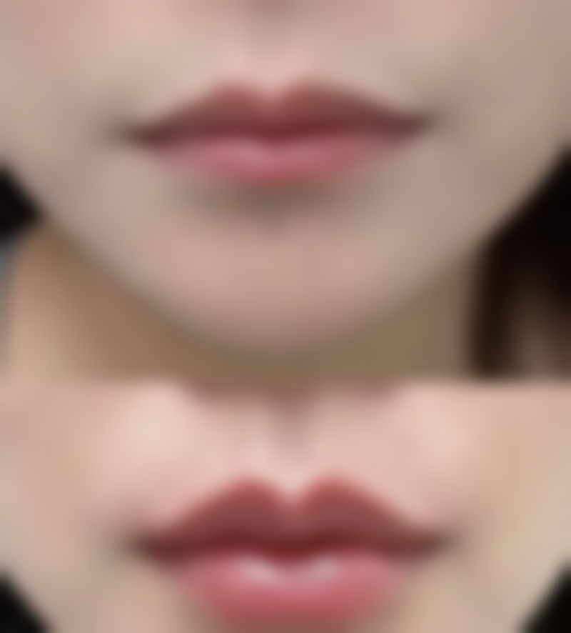 三、安阳仁济医院医疗美容科诊疗项目有哪些？