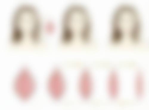 疤痕增生切除多久能修复