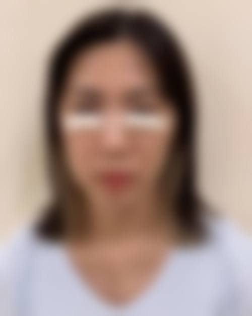 八、淄博星采医疗美容真实的患者评价