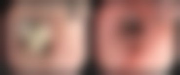 七、常熟市第一人民医院烧伤整形科预约方式