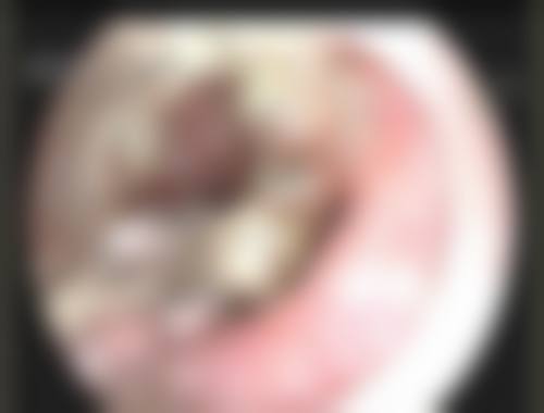 二、常熟市第一人民医院烧伤整形科怎么样？