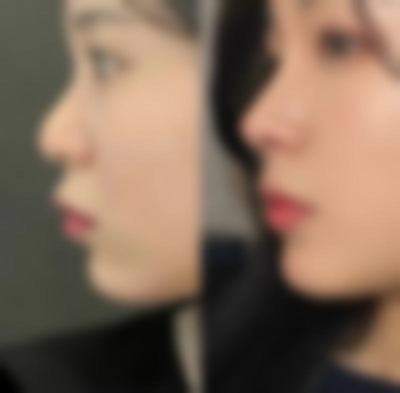 八、SOHYANG LAPORIS预约方式