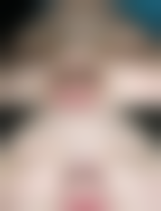 四、溧阳艾尚美医疗美容门诊部特色项目