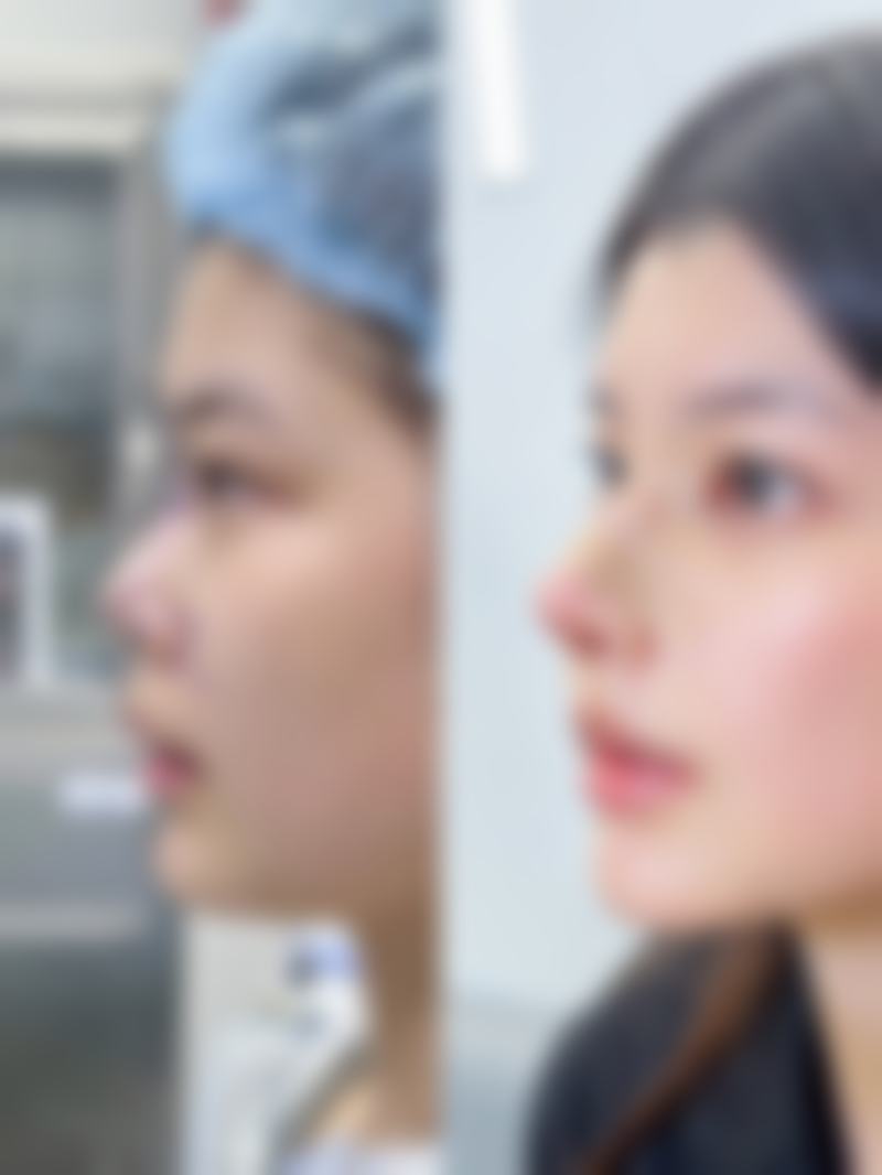 四、漳州芗城馨钰整形医院特色项目