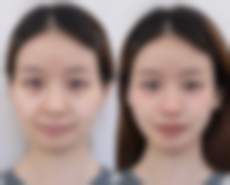 五、溧阳艾尚美医疗美容门诊部价格表