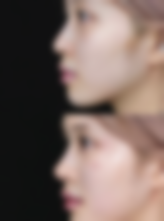 四、SOHYANG LAPORIS特色项目