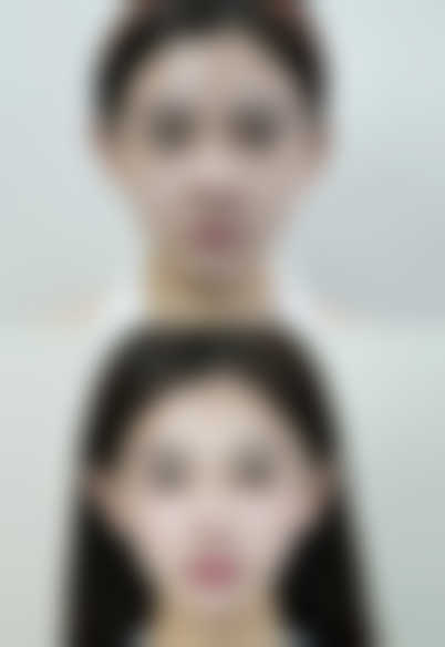 三、烧伤后的疤痕能治好吗？常见治疗方法大盘点