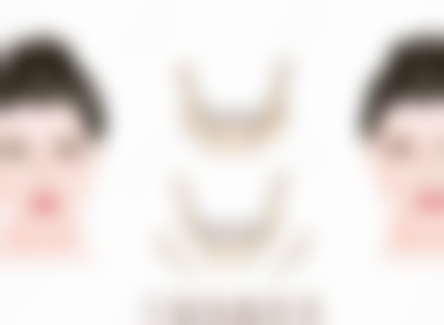 一岁的宝宝双眼皮怎么变单眼皮了呢 可能与这些因素有关你知道吗