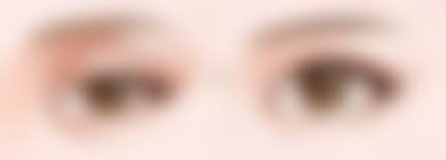 六、灵韵双眼皮术相关注意事项