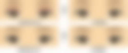 二、瘦脸针补打之个体差异