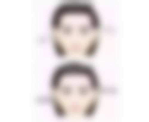 五、双眼皮哪几种眼型好看之欧式双眼皮