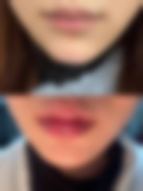 八、绵阳韩美整形医院预约方式