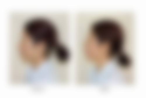 二、漳州龙文东扬医疗美容医院怎么样？