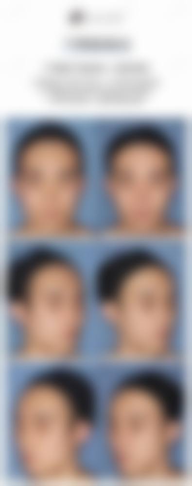 五、漳州龙文东扬医疗美容医院价格表