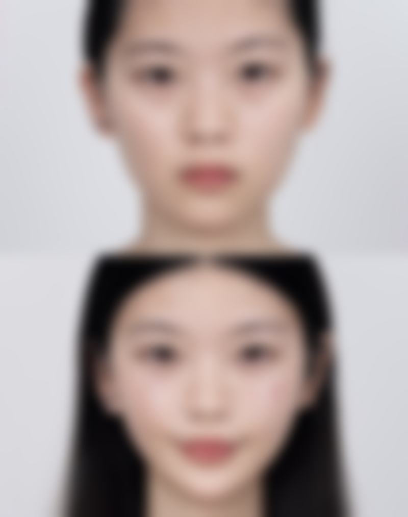 五、家长应对一岁的宝宝双眼皮变单眼皮的措施