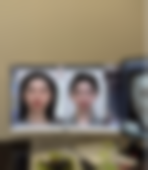 二、双眼皮哪几种眼型好看之平扇型双眼皮