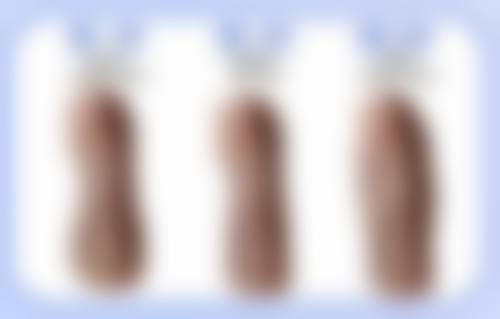 七、眼袋大是怎么会事？日常预防特别关键