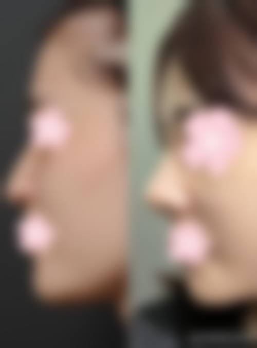 五、邹浅怎么预约？